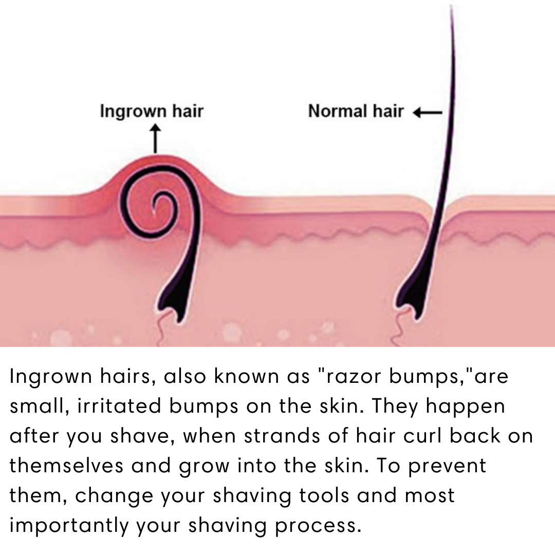 The beginner Shaving Kit To Prevent Razor Bumps